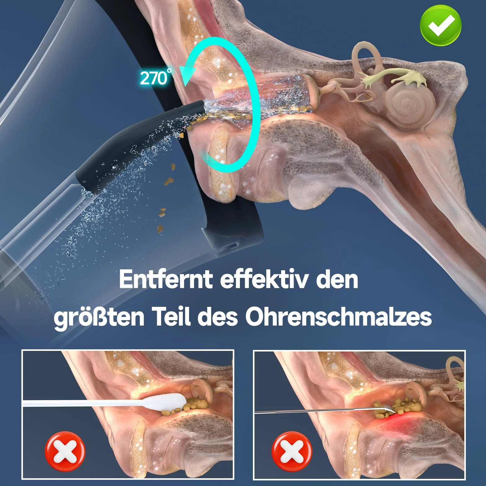 Eliminador de cerumen Morfone, funcionamiento con una sola mano, 4 modos, advertencias de seguridad, IPX6 resistente al agua, limpiador de oídos con 5 boquillas, Limpiador de oídos para adultos, extra